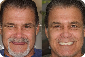 Patient Image