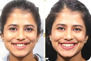 Patient Image
